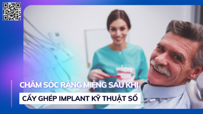 Chăm Sóc Răng Miệng Sau Khi Cấy Ghép Implant Kỹ Thuật Số