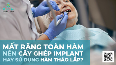 Mất Răng Toàn Hàm Nên Cấy Ghép Implant Hay Sử Dụng Hàm Tháo Lắp?