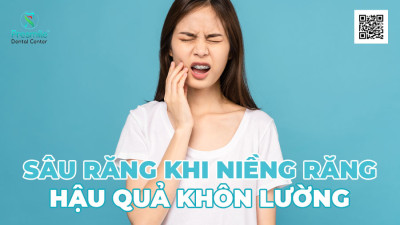 Sâu Răng Khi Niềng Răng, Hậu Quả Khôn Lường