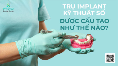 Trụ Implant Kỹ Thuật Số Được Cấu Tạo Như Thế Nào?