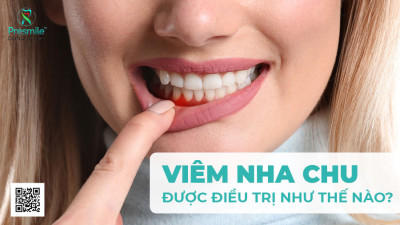 Viêm Nha Chu Được Điều Trị Như Thế Nào?