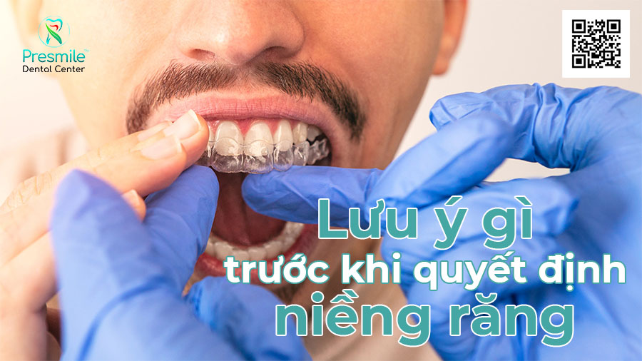 Lưu ý gì trước khi quyết định niềng răng