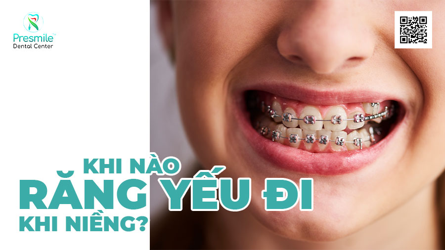 Khi nào răng yếu đi khi niềng?