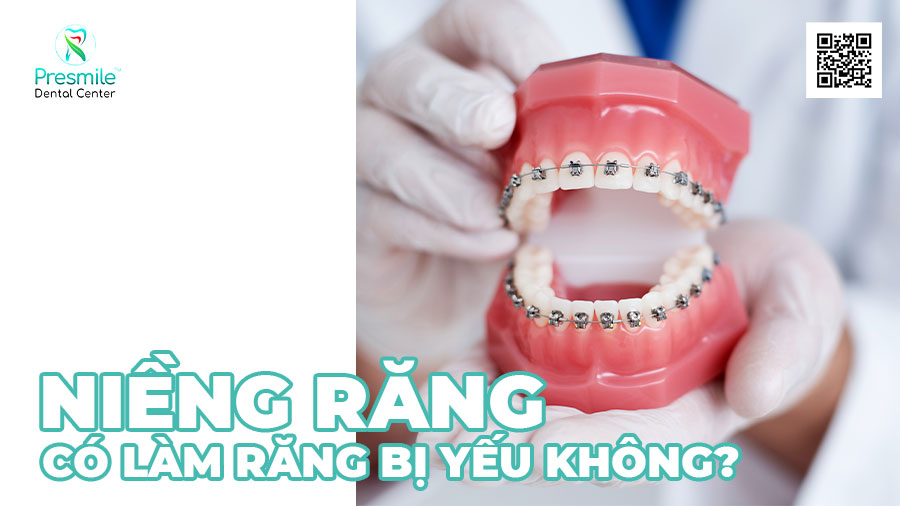 Niềng răng có làm răng yếu đi không?