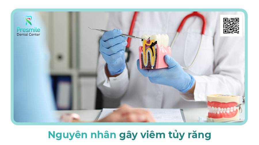 Nguyên nhân gây viêm tủy răng